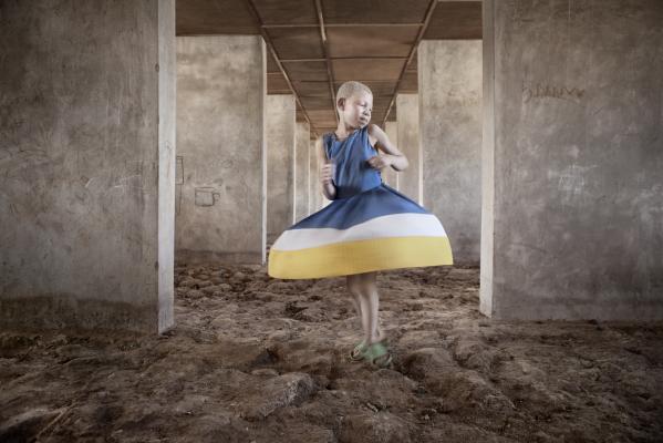 Albino / Ana Palacios / Gata Flora 14 / 2016